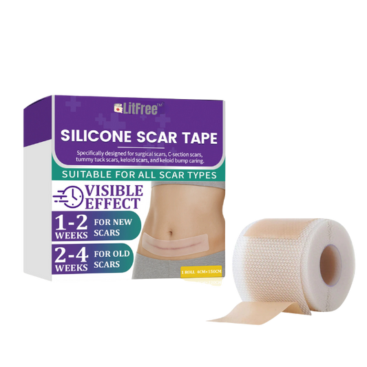 LitFree tape